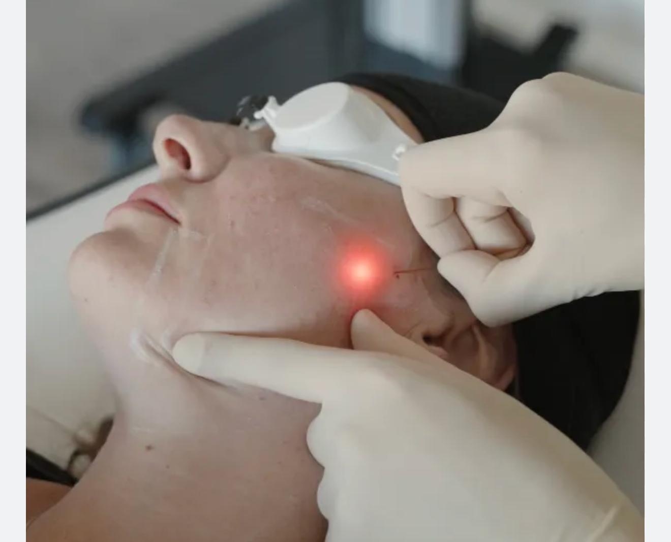 Endolift